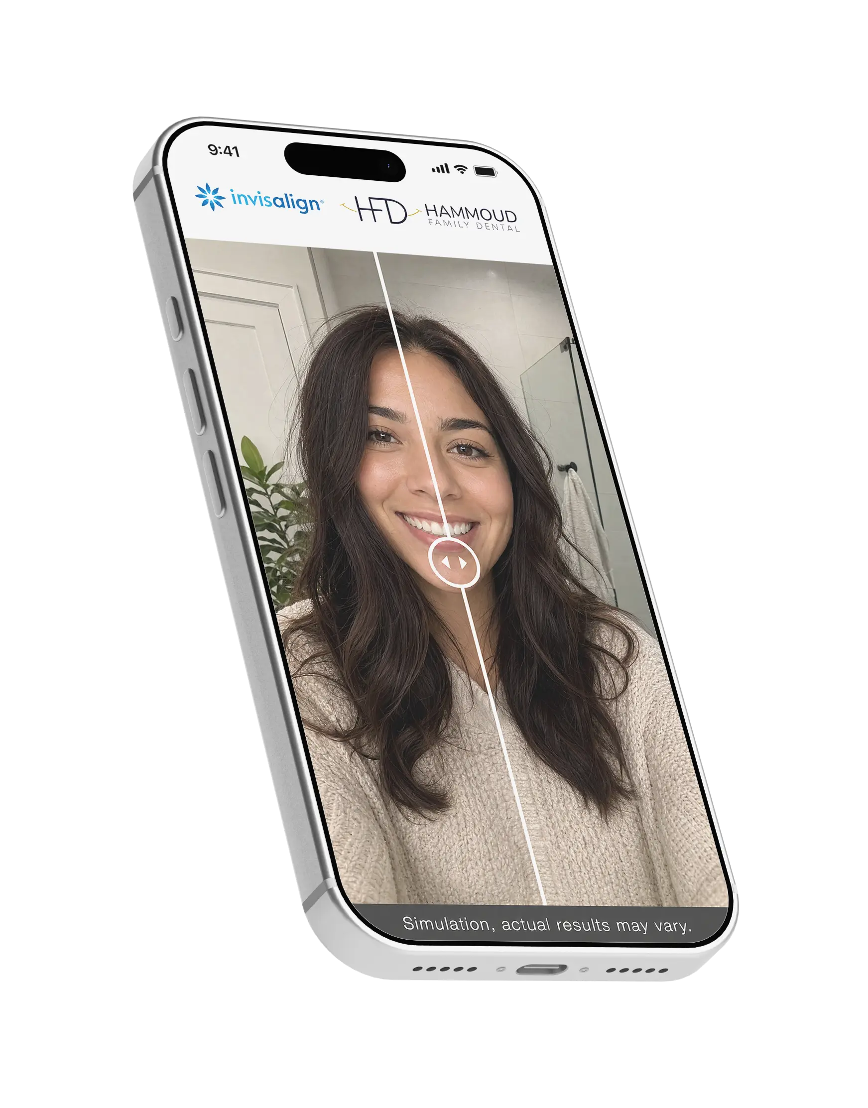 SmileView™ virtual try-on showing a before-and-after smile preview on iPhone